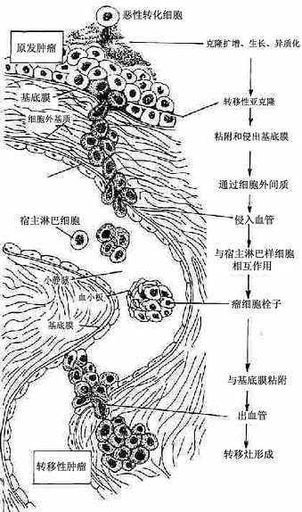 恶性肿瘤浸润和转移机制