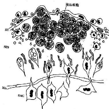 脂纹组织结构模式图