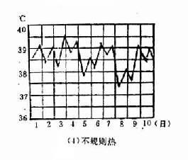 不规则热