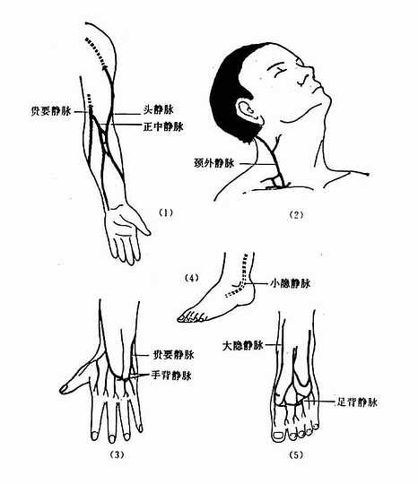 静脉注射部位