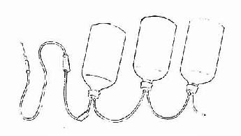 静脉连续滴入法