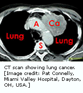 在第3条染色体上SCLC1基因的表达