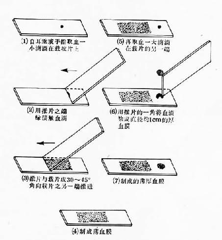 薄厚血膜制作步骤